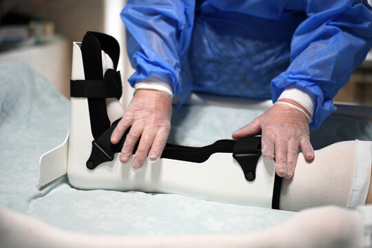 Medical Professional Adjusting Ankle Orthosis Brace. Doctor carefully correcting the fit of a orthopedic ankle foot orthosis (AFO) for a patient in a hospital bed. Focused on clinical rehabilitation