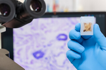 Scientist wear blue glove holding glasses slide and human tissue block, microscope and out of focus computer monitor show glandular image.Medical pathology and cytology laboratory technology concept