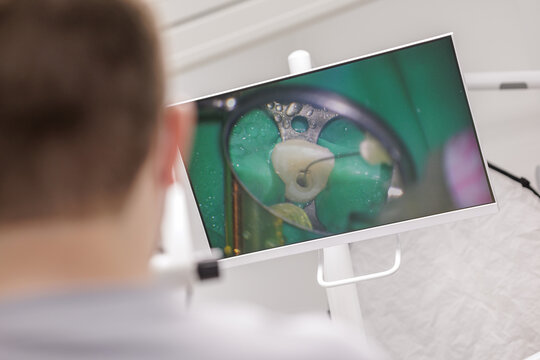 Dentist performing root canal therapy with rubber dam isolation