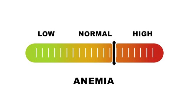 Anemia level indicator scale. Low Normal High meter infographic animation on white background. Animation showing high anemia level color gauge indicator for blood health and iron deficiency monitoring