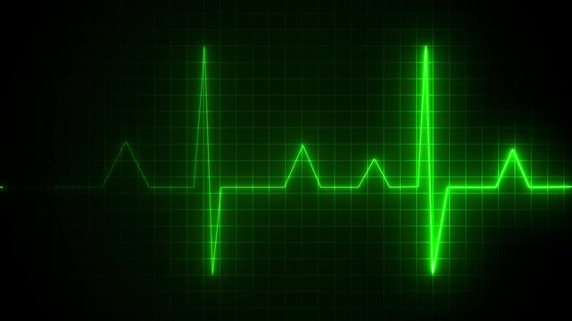 ECG heartbeat line glowing on a deep black background, with sharp pulse peaks and smooth flat segments, symbolizing heart activity, life monitoring, and Motion graphics of heartbeat line