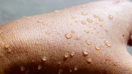 Water Droplets on Human Skin Close Up