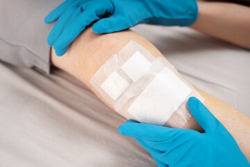 Fototapeta premium Healthcare worker in gloves carefully adjusts adhesive dressing on male patient bruised knee. Concept of professional wound management, nursing care, clinical hygiene in post-trauma recovery process