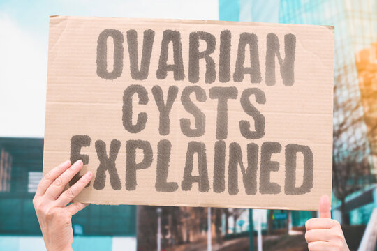 "Ovarian Cysts Explained" Ovarian cysts are fluid-filled sacs that commonly affect women during their reproductive years. OVARIAN. CYST. HEALTH. WOMEN. REPRODUCTIVE.