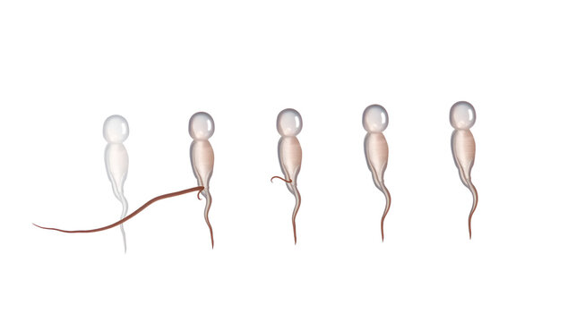 in vitro fertilization IVF semen test sample sperm count type Male biopsy fertility collect Low Poor Zero head anatomy midpiece tail birth control blocked defect abnormal ejaculate vas Non dry