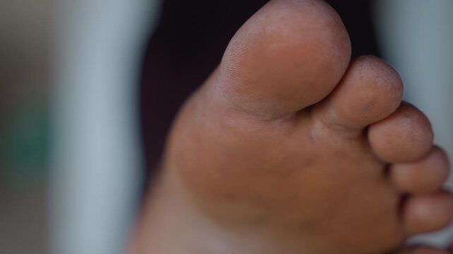 Foot skin closeup. Close view of foot skin after household tasks reveals dryness and cracks. Detailed examination of foot skin after household activities displays wear and rough texture signs