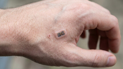 Fototapeta premium Man's hand with data chip implant under the skin close-up 