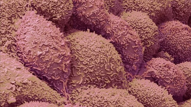 Post menopausal uterus, SEM
