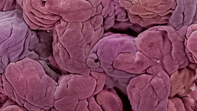 Uterine lining, SEM