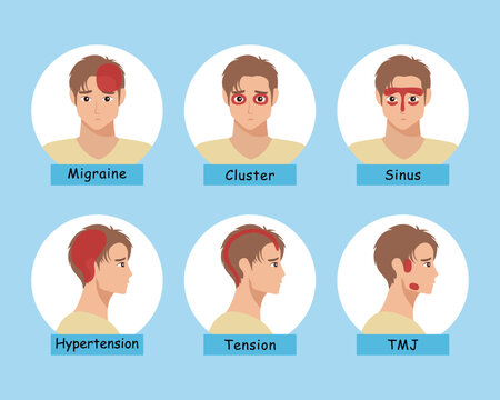 Male Headache Types and Pain Locations Infographic Set