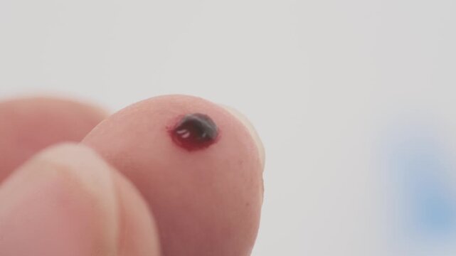 Finger prick for blood self-testing, Blood self-test procedure, showing finger prick step for personal health monitoring, convenience and accessibility at-home health diagnostics