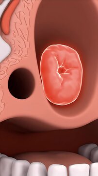3D CGI Visualization of Human Adenoids and Nasopharyngeal Lymphoid Tissue Educational Medical Animation Background