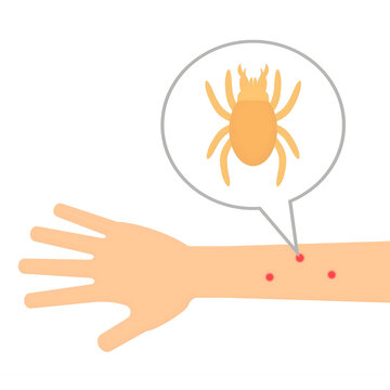A tick bite with a tick cartoon above it