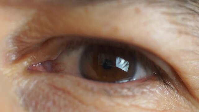 Detailed macro video of a young man's eye blinking and looking slightly upwards. The shot captures the texture of the skin, fine lines, and the intricate patterns of the brown iris