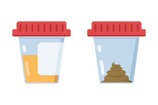 Flat cartoon vector illustration of feces and urine sample containers, medical laboratory test concept, plastic specimen cups isolated on white background for healthcare and diagnostic analysis.