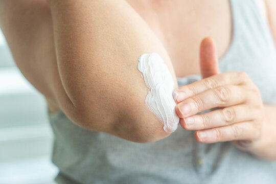 Cream on elbow skin. Applying the lotion to dry rough hands skin, elbow moisturizing creme