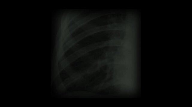 X ray scan animation. Abstract medical radiography scan effect on dark background