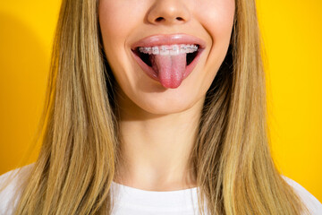Bright playful portrait of a young woman with braces on a yellow background
