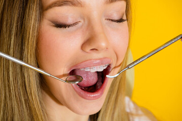 Young woman with braces smiles openly during a dental checkup with tools in view on a bright yellow...