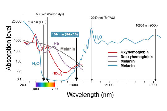 Scientific diagram showing absorption spectra of hemoglobin, melanin and water across wavelengths with medical laser lines. Educational illustration for dermatology, laser medicine and optics