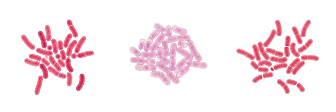 Mycobacterium tuberculosis bacteria isolated on white background, tuberculosis bacterium pathogen, acid fast mycobacteria microorganism, TB bacteria species medical microbiology laboratory sample