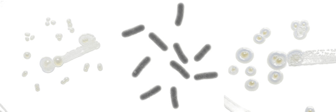 Haemophilus influenzae bacteria isolated on white background, Haemophilus influenzae gram negative coccobacillus bacterium, respiratory tract pathogen microorganism, clinical microbiology laboratory