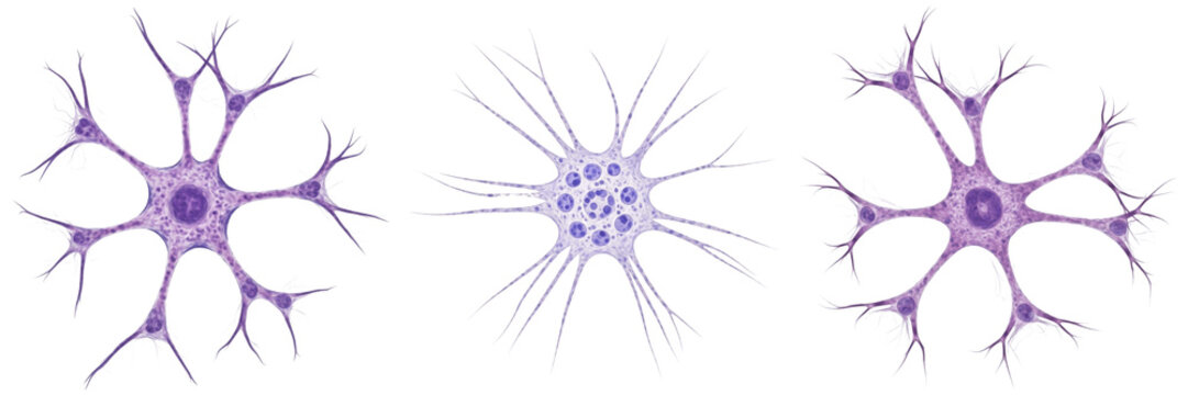 Hepatic stellate cell isolated on white background, liver pericyte cell, 肝星細胞 (Kan Hoshi Saibō), Hepatische Sternzelle, human liver sinusoidal cell, vitamin A storing cell, microscopic hepatic cell, c