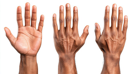Fototapeta premium Close-up of hands showing skin conditions and markings on palms and fingers