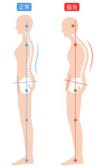 猫背と正しい姿勢　背骨と骨盤