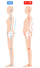 反り腰と正しい姿勢　背骨と骨盤