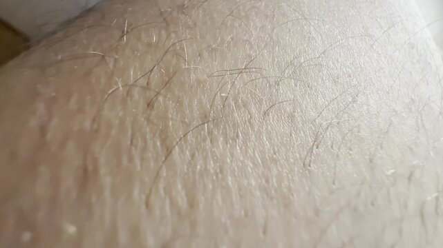 goosebumps on skin on male leg