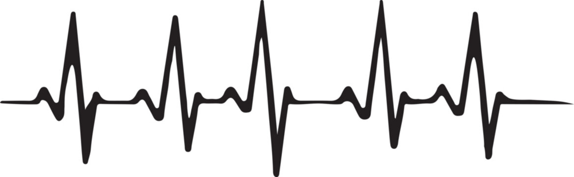An electrocardiogram reading showing a normal heart rhythm pattern on a white background