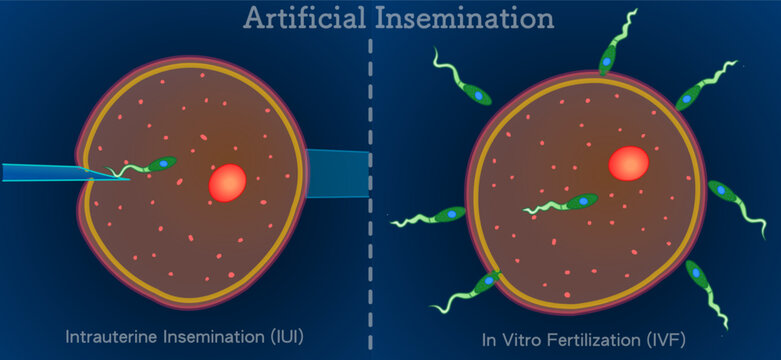 Artificial insemination ,AI. In vitro fertilization IVF. Infertility treatments, reproductive health. Dark background. Microbiology design. Illustration vector