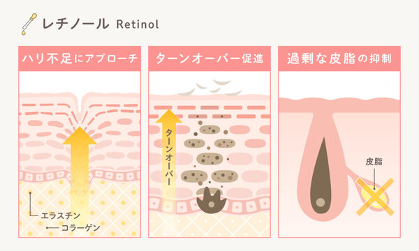 レチノールの作用メカニズム図解｜ハリ改善・ターンオーバー促進・皮脂抑制の美容イラスト