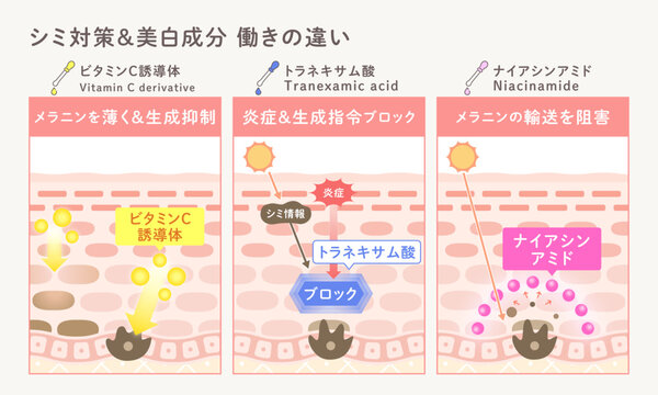 シミ対策・美白成分の働きの違いを解説した図解｜ビタミンC誘導体・トラネキサム酸・ナイアシンアミド