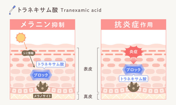 トラネキサム酸の美白作用｜メラニン生成抑制とシミ・肝斑対策のスキンケア成分図解