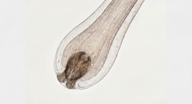 Microscopic view of human hair bulb and dermal papilla