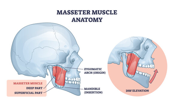 Masseter anatomy, labeled masseter muscle linking zygomatic arch to mandible, illustrating jaw elevation and chewing function, key objects, masseter, skull, mandible, transparent background.