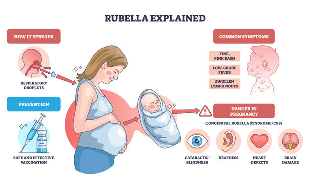 Rubella explained shows how infection spreads, risks in pregnancy and newborn outcomes, key elements, pregnant woman, infant, vaccine icons, transparent background.