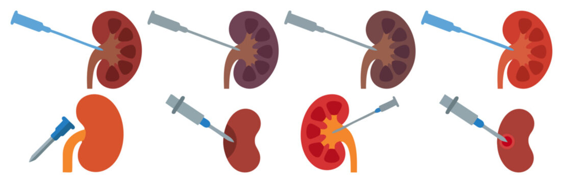  BIOPSY NEEDLE - Thin medical needle touching a kidney section  Flat Vector Illustration on Transparent Background