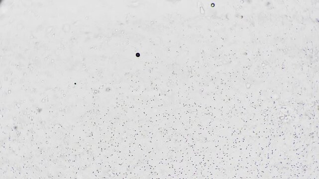 Microscopic human sperm sample with low concentration, andrologist assessing count on brightfield slide sparse motile cells scattered across coverslip, clinical lab lighting and diagnostic focus.