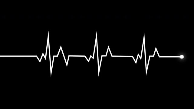 Heartbeat Ecg Monitor Pulse Line Animation White Isolated On Black Background