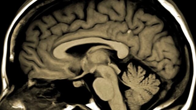 CT Scan of Human Brain Medical Imaging Diagnostic Technology