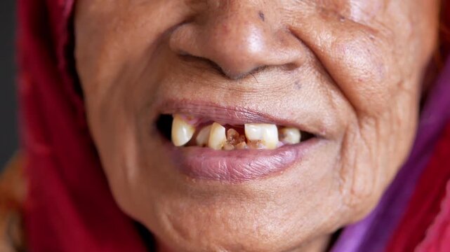 Elderly asian woman smiling close up with visible dental problems showing her broken teeth and gums in slow motion