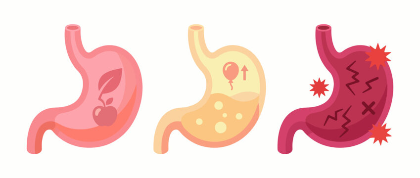 The image illustrates the human digestive system with variations in stomach states, showcasing the processes of digestion, nutrition, and the impact on health and wellbeing.