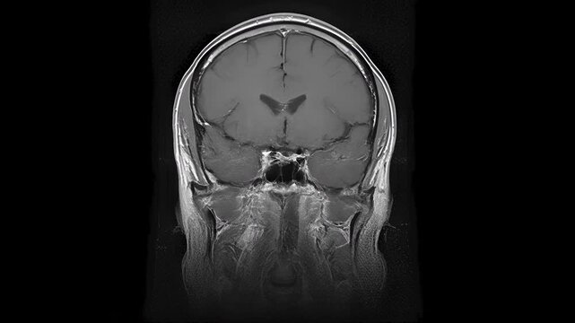 Neural Mapping and Navigation in MRI of the Brain. MRI scanning with spatial layer analysis in brain research demonstrates the technology's high effectiveness in detecting abnormalities