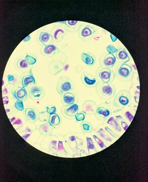 View of lily anther cells undergoing meiosis, a type of cell division, as seen under a compound or light microscope in a science or biology laboratory.