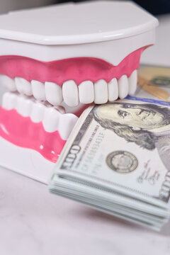 Un mod&egrave;le 3D de dentier tenant de l'argent, signifiant les frais dentaires. Le format est vertical.