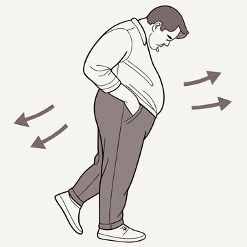 Overweight man walking with a stoop illustrating poor posture and health concerns.