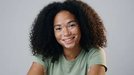 Portrait of a happy and confident young woman with vitiligo skin condition smiling on a neutral background.